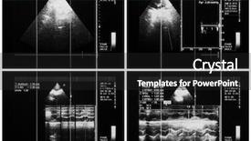  Presentation with medical ultrasound - Audience pleasing PPT theme consisting of heart valve - medical examination - ultrasound study backdrop and a dark gray colored foreground