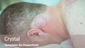  Presentation with body - PPT layouts with hijama - man taking cupping therapy background and a coral colored foreground