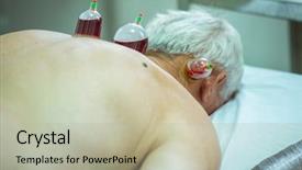  Presentation with body - Beautiful theme featuring hijama - man taking cupping therapy backdrop and a mint green colored foreground