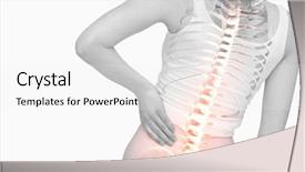  Presentation with spine - Amazing presentation theme having woman with back pain backdrop and a white colored foreground