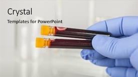  Presentation with hiv aids - Colorful PPT theme enhanced with hiv aids - hand holding blood sample backdrop and a light gray colored foreground