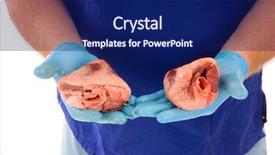  Presentation with comparison - Presentation with holding a pair of heart background and a navy blue colored foreground