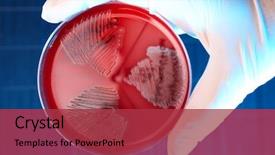  Presentation with bacteria - Audience pleasing presentation theme consisting of holding petri plate with bacteria backdrop and a red colored foreground