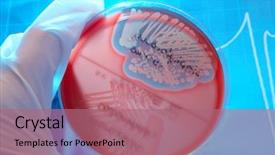  Presentation with bacteria staphylococcus aureus - Slides consisting of holding petri plate with bacteria background and a coral colored foreground