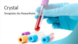  Presentation with testing blood - Cool new theme with holding test tube with blood backdrop and a white colored foreground