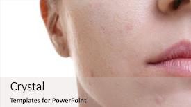  Presentation with hormone - Amazing PPT theme having hormone - face of beautiful young woman backdrop and a soft green colored foreground