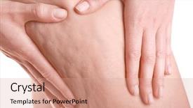  Presentation with hormone - Theme enhanced with hormone - woman with cellulite problem closeup background and a coral colored foreground