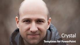  Presentation with hair loss - Beautiful presentation featuring human alopecia or hair loss backdrop and a tawny brown colored foreground