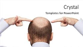  Presentation with bald - Presentation design enhanced with human alopecia or hair loss background and a white colored foreground