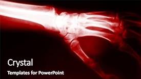  Presentation with classic - Presentation theme enhanced with human anatomy - classic red x-ray image background and a black colored foreground