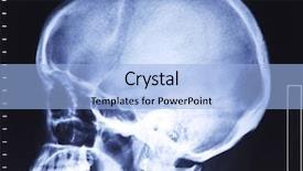  Presentation with xray - Slides enhanced with human anatomy - fine image of medical xray background and a light blue colored foreground