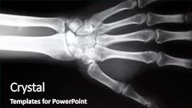  Presentation with medical hand - Theme consisting of human anatomy - hand x-ray image medical background background and a black colored foreground