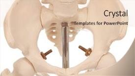  Presentation with pelvis - Slide set with human anatomy - pelvis and hips background and a lemonade colored foreground