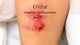  Presentation with wound - Beautiful PPT theme featuring human anatomy - wound backdrop and a coral colored foreground