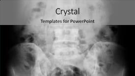  Presentation with human pelvis - Amazing theme having human anatomy - x-ray of the pelvis backdrop and a light gray colored foreground