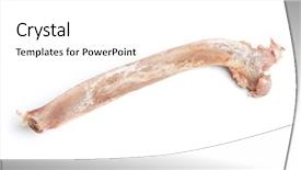  Presentation with bone marrow transplant - Beautiful slide set featuring human animal anatomy - bone isolated on white background backdrop and a  colored foreground