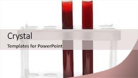  Presentation with blood test - Audience pleasing presentation theme consisting of human factors - test tubes with blood isolated backdrop and a soft green colored foreground