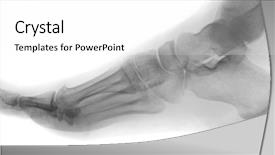  Presentation with human foot - Cool new slide deck with human foot backdrop and a white colored foreground