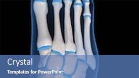  Presentation with human foot - Amazing presentation theme having arthrosis - human foot backdrop and a teal colored foreground