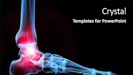  Presentation with human foot - Colorful PPT layouts enhanced with human foot backdrop and a black colored foreground