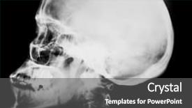  Presentation with head anatomy - PPT layouts with human head x-ray film background and a dark gray colored foreground