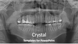  Presentation with human mouth - Cool new presentation design with x-ray shoot of human backdrop and a gray colored foreground