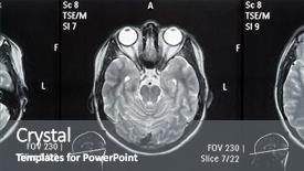  Presentation with nervous system - Colorful slides enhanced with human nervous system - real brain mri slide backdrop and a gray colored foreground