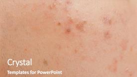  Presentation with acne - Cool new PPT theme with human skin with acne closeup backdrop and a coral colored foreground