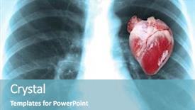  Presentation with human heart - Beautiful slide set featuring human x-ray with heart backdrop and a teal colored foreground