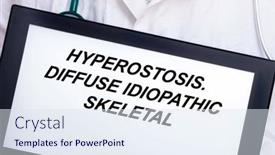  Presentation with disease - PPT layouts having hyperostosis-doctor-with-rare background and a sky blue colored foreground