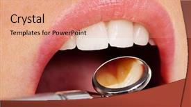  Presentation with dental implant - Amazing theme having implant - teeth of a young woman backdrop and a coral colored foreground