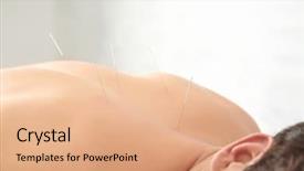  Presentation with needles - Slide deck consisting of nerve impulses - man's back with needles acupuncture background and a coral colored foreground