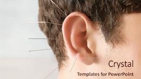  Presentation with acupuncture - Cool new PPT layouts with nerve impulses - man's ear with needles closeup backdrop and a lemonade colored foreground