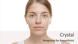  Presentation with beautiful skin - Amazing presentation having inflammable - beautiful young woman with problem backdrop and a soft green colored foreground