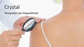  Presentation with melanoma - PPT theme having initiatives - doctor examining melanoma on woman background and a white colored foreground