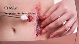  Presentation with white blood cell - Amazing presentation theme having injured abdomen with blood isolated backdrop and a coral colored foreground