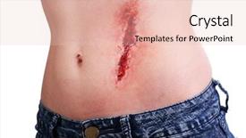  Presentation with white blood cell - Beautiful slides featuring injured abdomen with blood isolated backdrop and a lemonade colored foreground