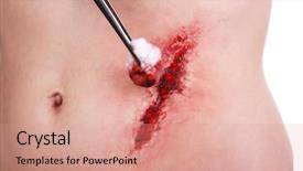  Presentation with white blood cell - Amazing slides having injured abdomen with blood isolated backdrop and a coral colored foreground