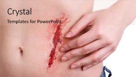  Presentation with white blood cell - Beautiful theme featuring injured abdomen with blood isolated backdrop and a lemonade colored foreground