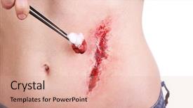  Presentation with blood - Colorful slide set enhanced with injured abdomen with blood isolated backdrop and a coral colored foreground