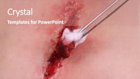  Presentation with blood - Audience pleasing slide deck consisting of injured abdomen with blood isolated backdrop and a coral colored foreground