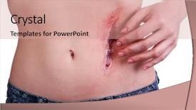  Presentation with white blood cell - Presentation having injured abdomen with blood isolated background and a coral colored foreground