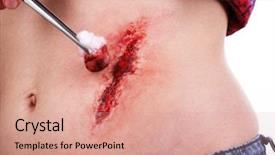  Presentation with white blood cell - Slides featuring injured abdomen with blood isolated background and a  colored foreground