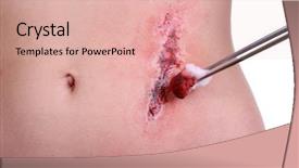  Presentation with white blood cell - PPT theme having injured abdomen with blood isolated background and a lemonade colored foreground