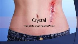  Presentation with trauma - Audience pleasing slides consisting of injured abdomen with blood backdrop and a coral colored foreground