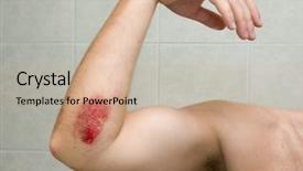  Presentation with wound care - Amazing PPT theme having inline skating accident the wound backdrop and a soft green colored foreground