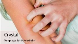  Presentation with skin - Amazing slide deck having insect systems - woman itchy skin backdrop and a coral colored foreground