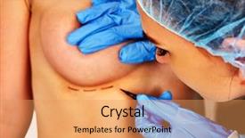  Presentation with breast surgery - Audience pleasing PPT layouts consisting of installation of new silicone implant backdrop and a yellow colored foreground