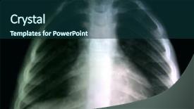  Presentation with neck x ray - Slide set featuring black body radiation - x-ray background and a  colored foreground