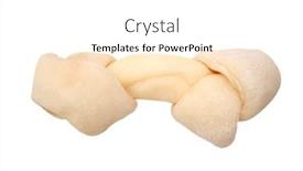  Presentation with bone - 